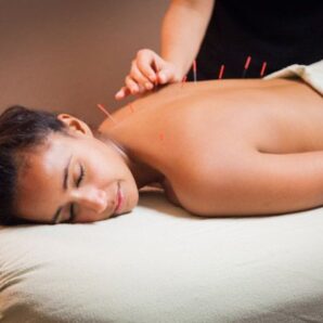 Acupuncture