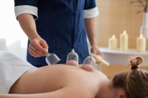 Cupping